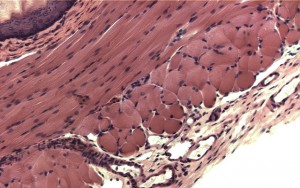 Dog esophagus imaged by an LS400